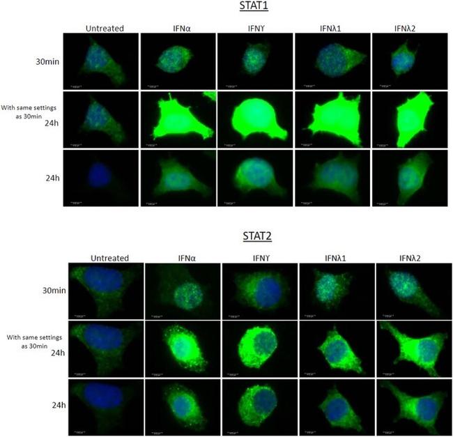 STAT2 Antibody in Immunocytochemistry (ICC/IF)