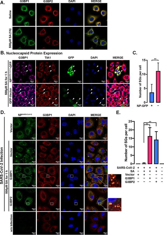 TIA1/TIAL1 Antibody in Immunocytochemistry (ICC/IF)