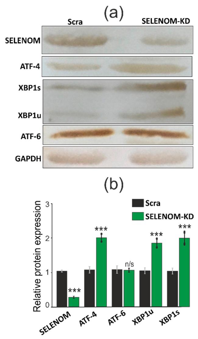 ATF6 Antibody in Western Blot (WB)