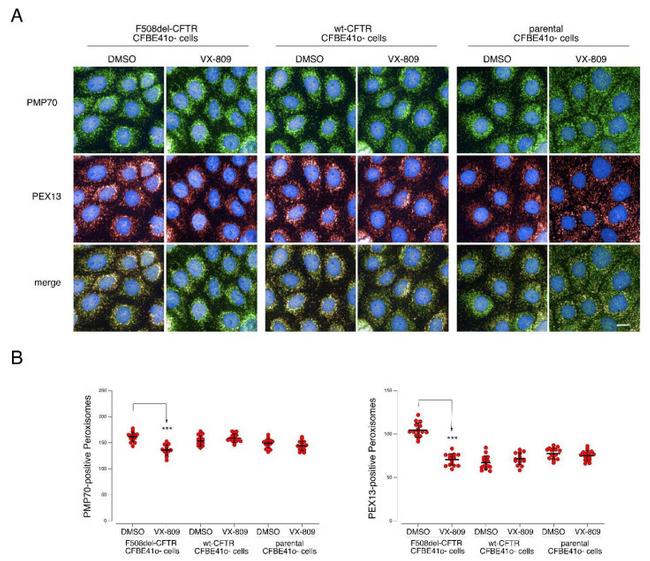 PMP70 Antibody in Immunocytochemistry (ICC/IF)