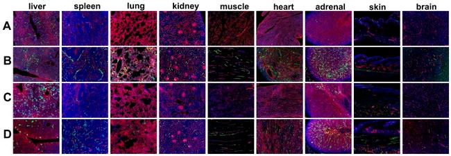 Endomucin Antibody in Immunohistochemistry (IHC)