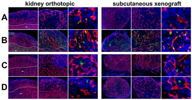 Endomucin Antibody in Immunohistochemistry (IHC)