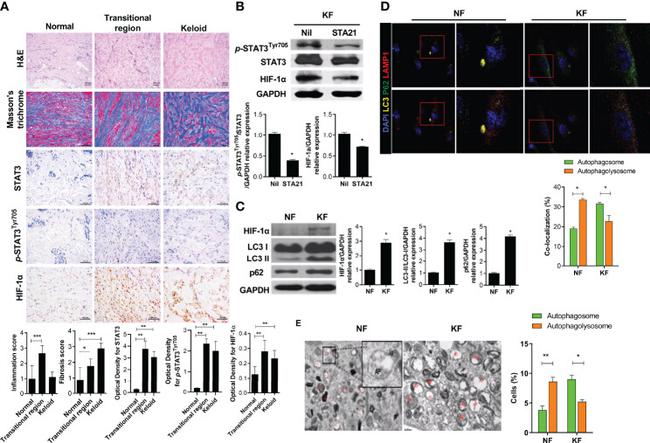 HIF1A Antibody in Immunohistochemistry (IHC)