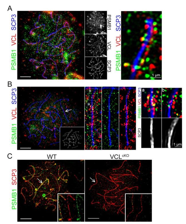 PSMB1 Antibody in Immunocytochemistry (ICC/IF)