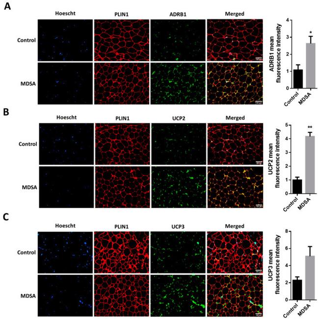 beta-1 Adrenergic Receptor Antibody in Immunohistochemistry (IHC)