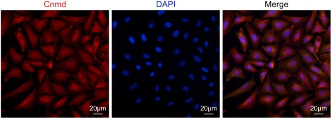 LECT1 Antibody in Immunocytochemistry (ICC/IF)