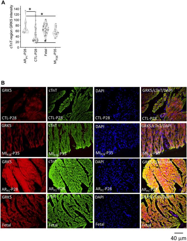 GRK5 Antibody in Immunohistochemistry (Frozen) (IHC (F))