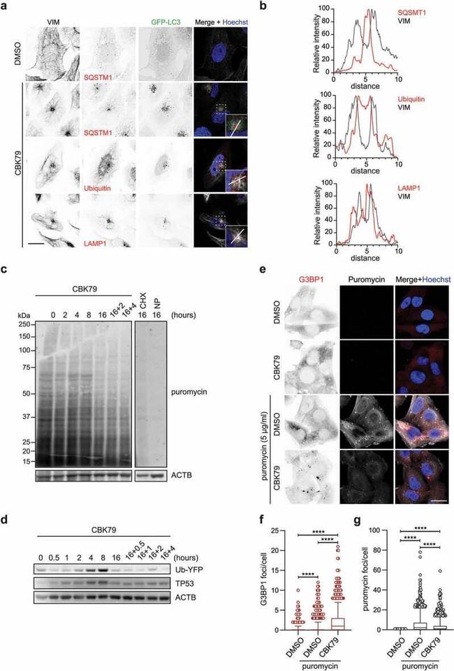 G3BP1 Antibody in Immunocytochemistry (ICC/IF)