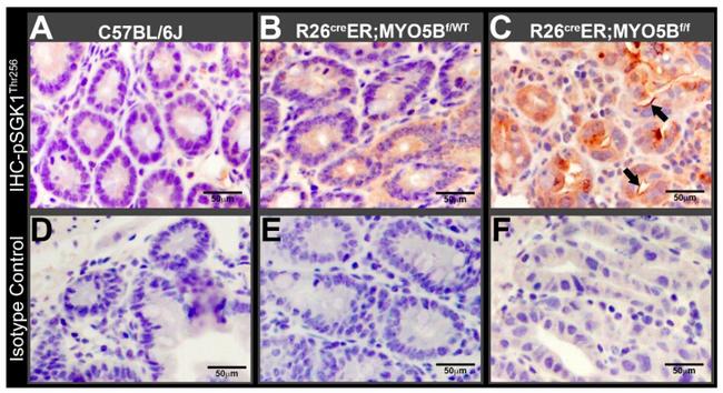 Phospho-SGK1 (Thr256) Antibody in Immunohistochemistry (IHC)