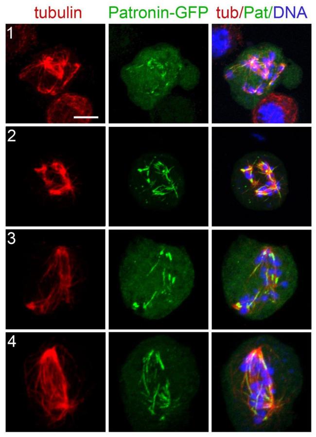 GFP Antibody in Immunocytochemistry (ICC/IF)