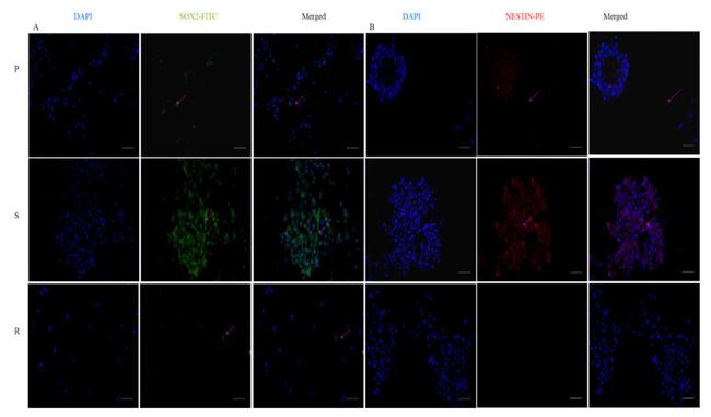 SOX2 Antibody in Immunocytochemistry (ICC/IF)