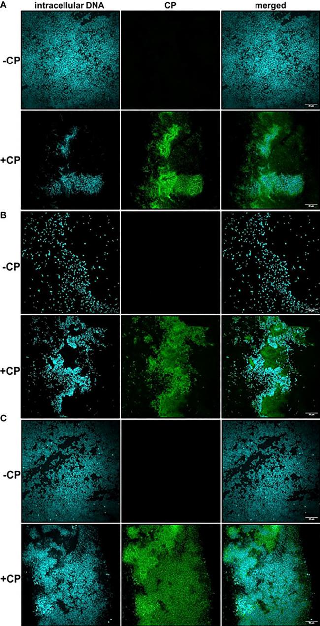 S100A8 Antibody in Immunocytochemistry (ICC/IF)