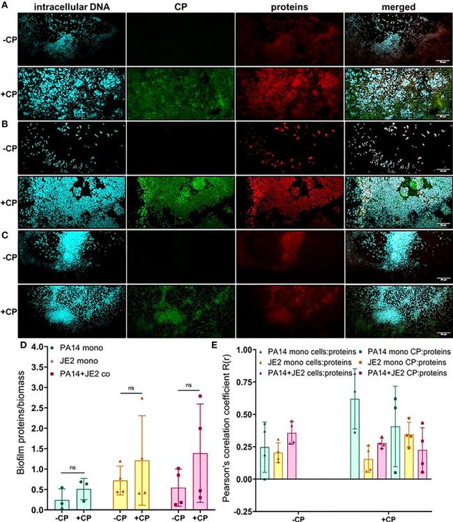 S100A8 Antibody in Immunocytochemistry (ICC/IF)