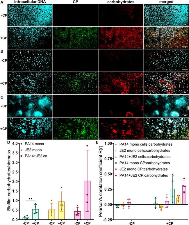 S100A8 Antibody in Immunocytochemistry (ICC/IF)