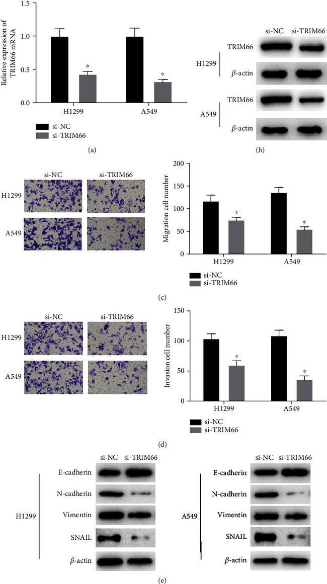 beta Actin Antibody in Western Blot (WB)