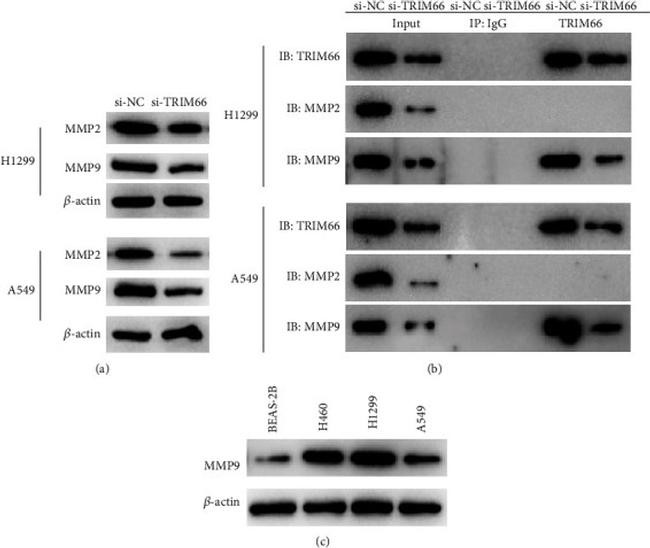 MMP9 Antibody in Western Blot (WB)