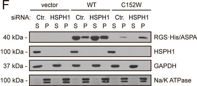 Rat IgG (H+L) Secondary Antibody in Western Blot (WB)