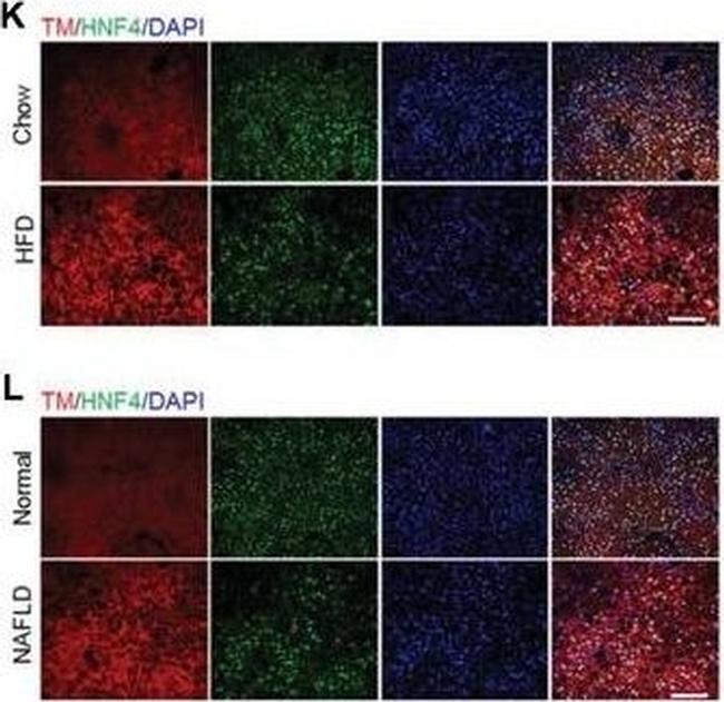 Mouse IgG (H+L) Secondary Antibody in Immunohistochemistry (IHC)