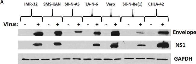 Mouse IgG (H+L) Secondary Antibody in Western Blot (WB)