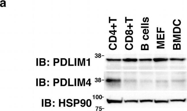 Rabbit IgG (H+L) Secondary Antibody in Western Blot (WB)