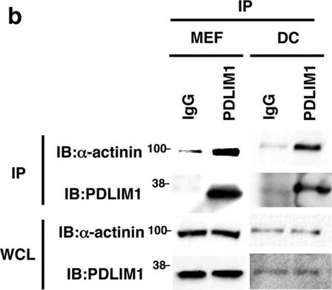 Rabbit IgG (H+L) Secondary Antibody in Western Blot (WB)