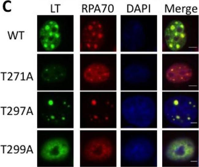 Rabbit IgG (H+L) Cross-Adsorbed Secondary Antibody in Immunocytochemistry (ICC/IF)