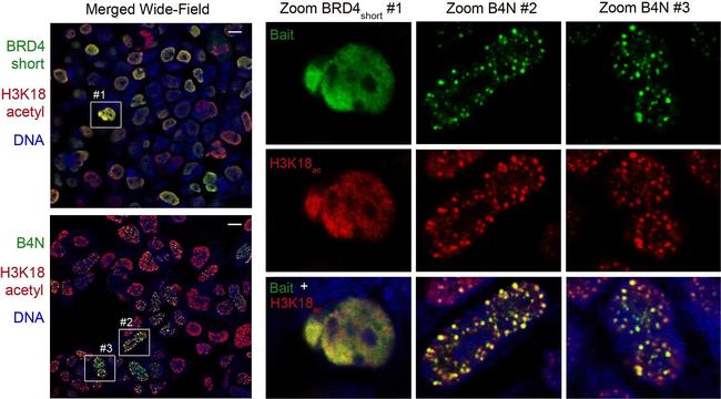 Rabbit IgG (H+L) Cross-Adsorbed Secondary Antibody in Immunocytochemistry (ICC/IF)