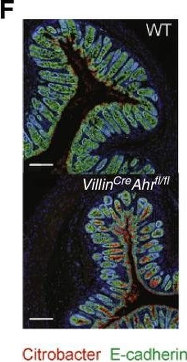 Rabbit IgG (H+L) Highly Cross-Adsorbed Secondary Antibody in Immunohistochemistry (IHC)