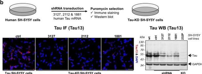 Mouse IgG (H+L) Highly Cross-Adsorbed Secondary Antibody in Immunocytochemistry (ICC/IF)