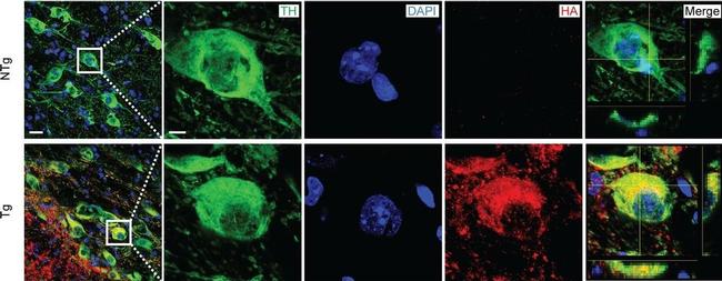 Rabbit IgG (H+L) Cross-Adsorbed Secondary Antibody in Immunohistochemistry (IHC)