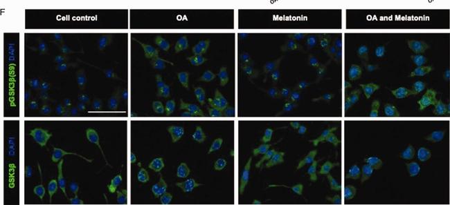 Rabbit IgG (H+L) Cross-Adsorbed Secondary Antibody in Immunocytochemistry (ICC/IF)