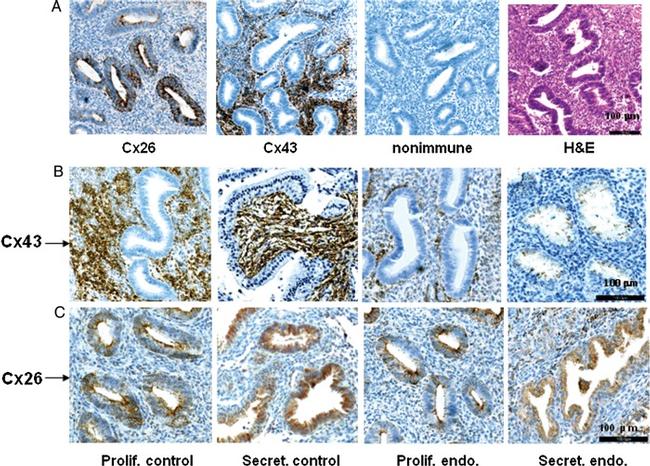 Connexin 26 Antibody in Immunohistochemistry (IHC)