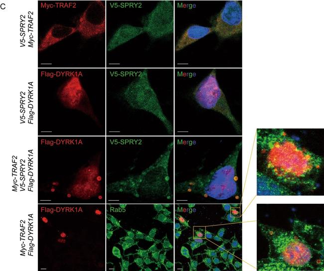 Mouse IgG (H+L) Cross-Adsorbed Secondary Antibody in Immunocytochemistry (ICC/IF)