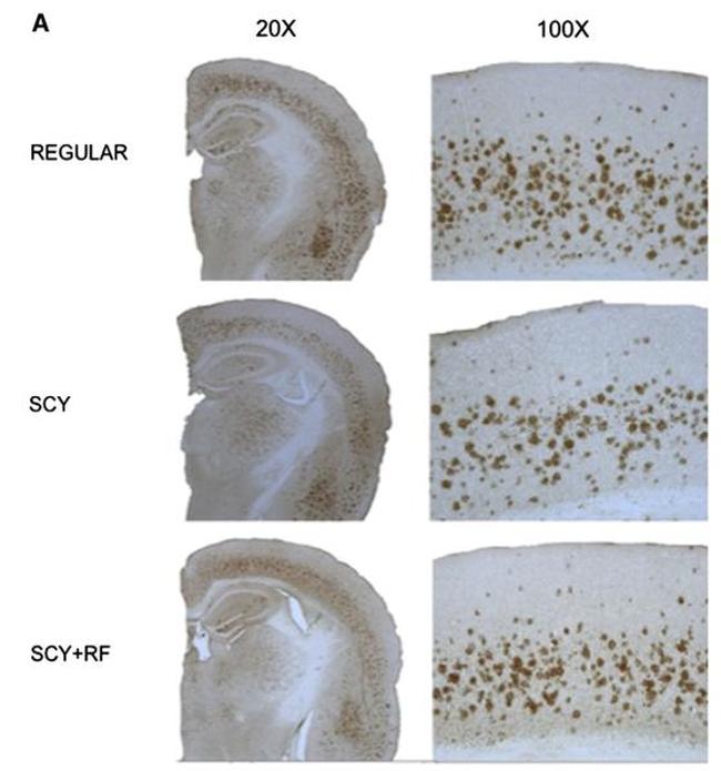 beta Amyloid (1-42) Antibody in Immunohistochemistry (IHC)