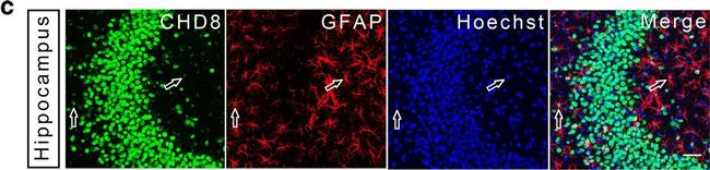 Mouse IgG (H+L) Cross-Adsorbed Secondary Antibody in Immunohistochemistry (PFA fixed) (IHC (PFA))