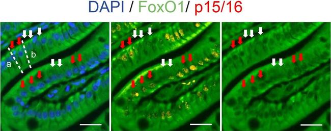 Mouse IgG (H+L) Cross-Adsorbed Secondary Antibody in Immunohistochemistry (Paraffin) (IHC (P))