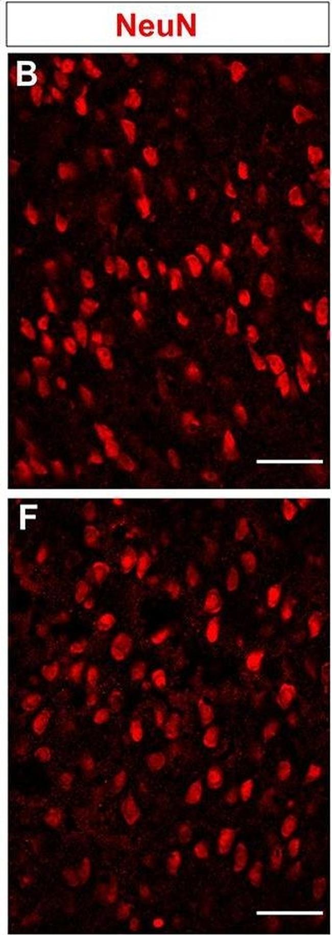 Mouse IgG (H+L) Cross-Adsorbed Secondary Antibody in Immunohistochemistry (IHC)