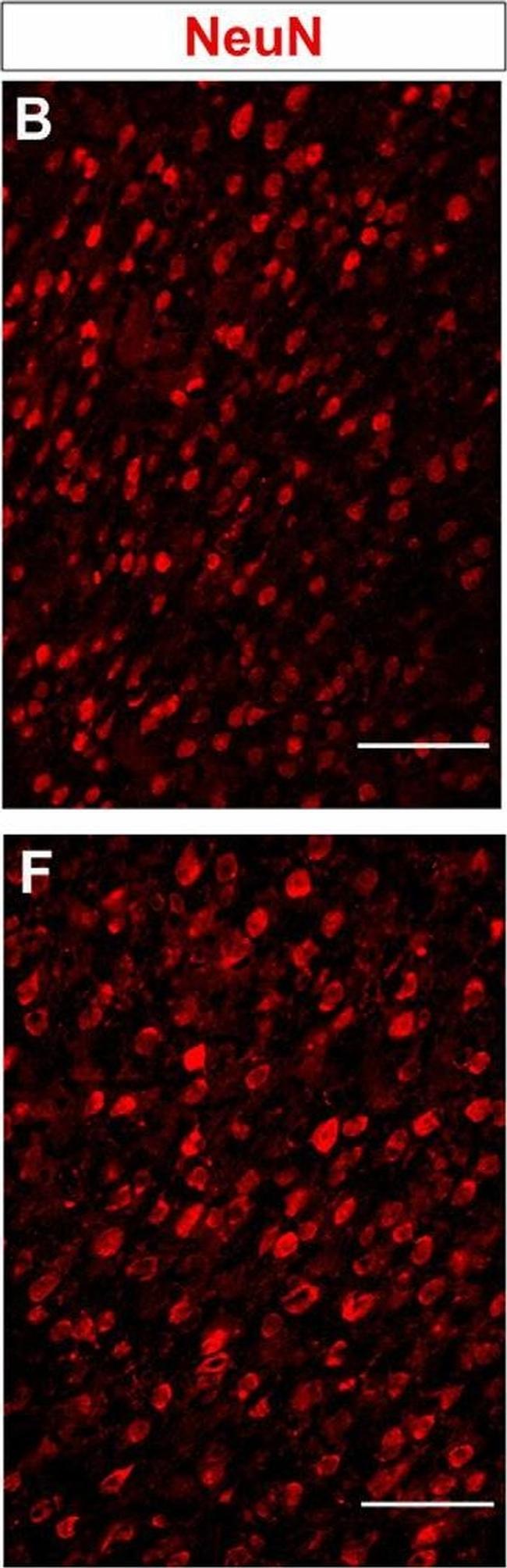 Mouse IgG (H+L) Cross-Adsorbed Secondary Antibody in Immunohistochemistry (IHC)