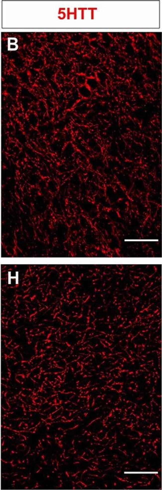 Mouse IgG (H+L) Cross-Adsorbed Secondary Antibody in Immunohistochemistry (IHC)