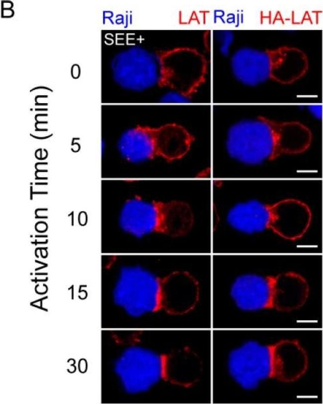 Mouse IgG (H+L) Cross-Adsorbed Secondary Antibody in Immunocytochemistry (ICC/IF)