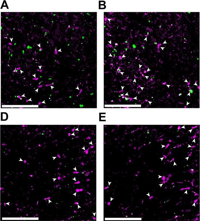 Rat IgG (H+L) Cross-Adsorbed Secondary Antibody in Immunohistochemistry (IHC)