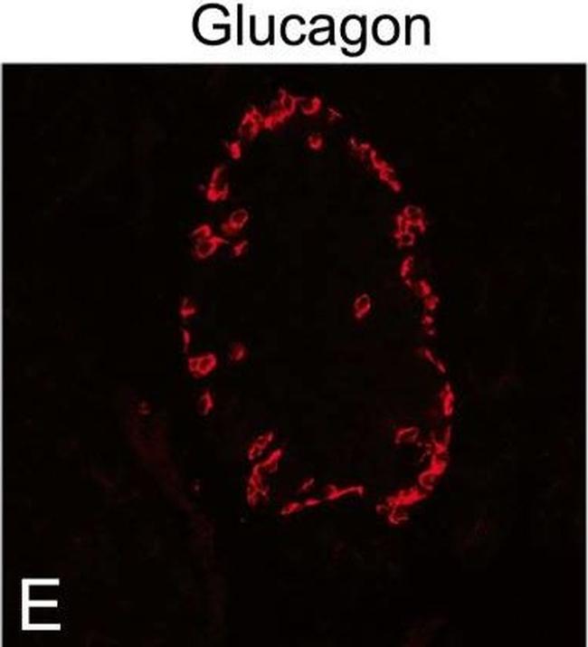 Guinea Pig IgG (H+L) Highly Cross-Adsorbed Secondary Antibody in Immunocytochemistry (ICC/IF)