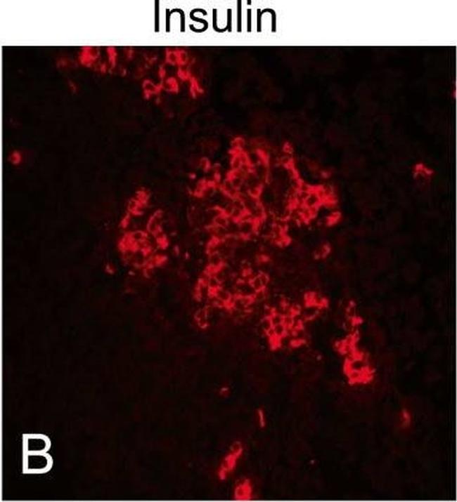 Guinea Pig IgG (H+L) Highly Cross-Adsorbed Secondary Antibody in Immunocytochemistry (ICC/IF)