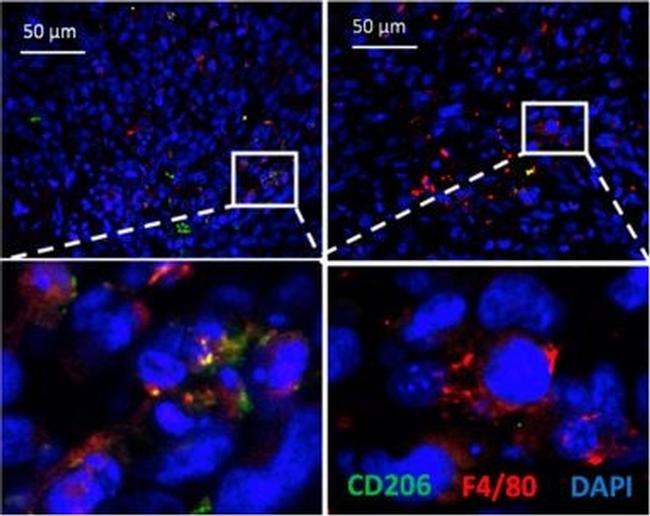 Rat IgG (H+L) Cross-Adsorbed Secondary Antibody in Immunohistochemistry (Paraffin) (IHC (P))