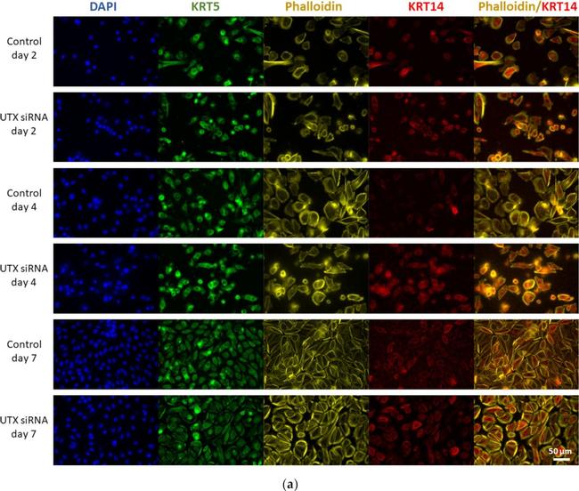 Mouse IgG (H+L) Highly Cross-Adsorbed Secondary Antibody in Immunocytochemistry (ICC/IF)