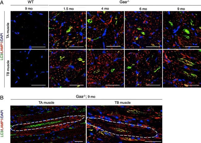 Rat IgG (H+L) Cross-Adsorbed Secondary Antibody in Immunohistochemistry (Frozen) (IHC (F))