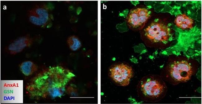 Mouse IgG (H+L) Highly Cross-Adsorbed Secondary Antibody in Immunocytochemistry (ICC/IF)