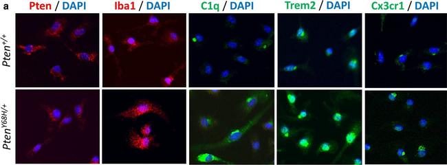 Rabbit IgG (H+L) Cross-Adsorbed Secondary Antibody in Immunocytochemistry (ICC/IF)