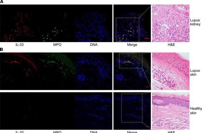 Rabbit IgG (H+L) Cross-Adsorbed Secondary Antibody in Immunocytochemistry (ICC/IF)