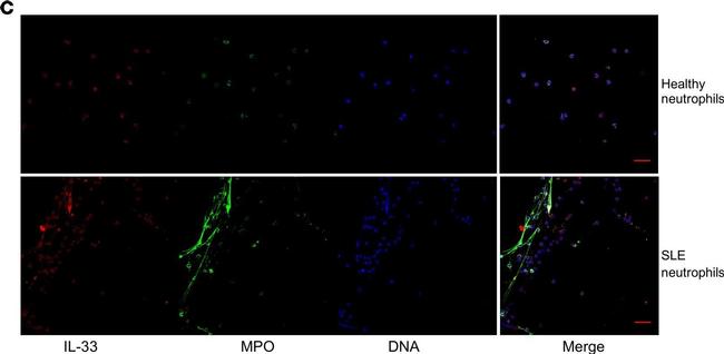 Rabbit IgG (H+L) Cross-Adsorbed Secondary Antibody in Immunocytochemistry (ICC/IF)